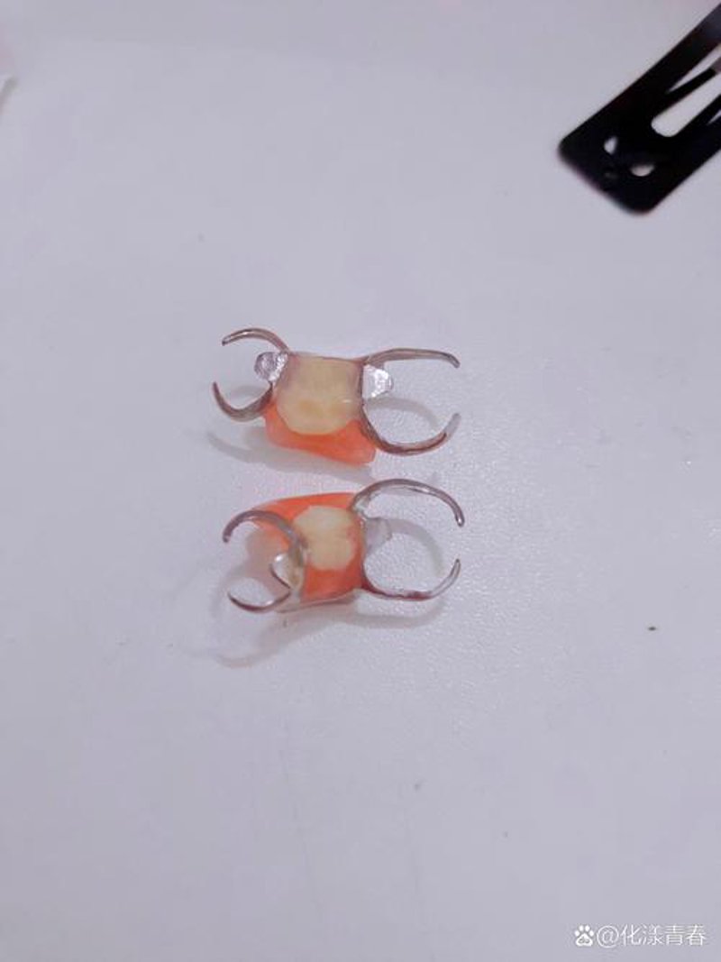 烤瓷牙走进现代口腔护理